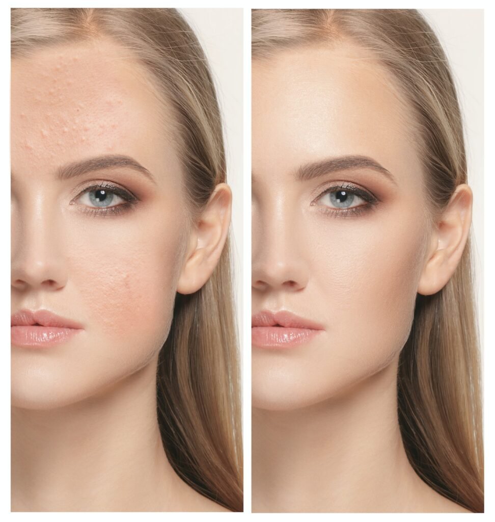 Woman before and after treatment