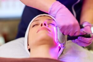 young woman having face microdermabrasion at spa